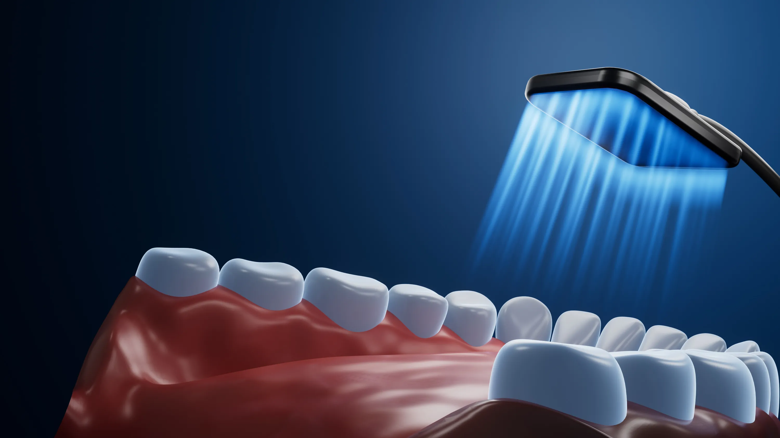 سنسور دندانپزشکی RVG از بوندنت Bondent مدل Bonsensor